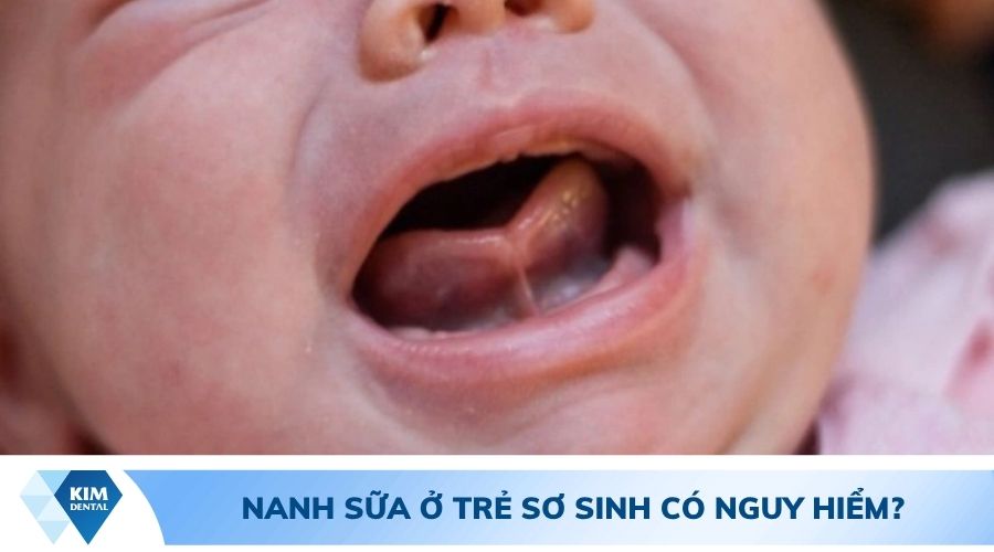 nanh cửa ở trẻ có nguy hiểm không