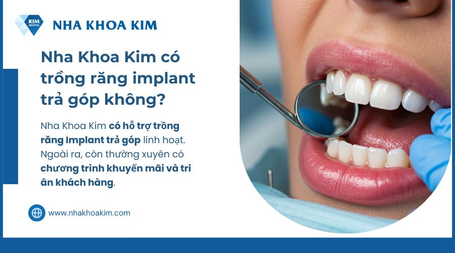 nha khoa kim có trồng răng trả góp không