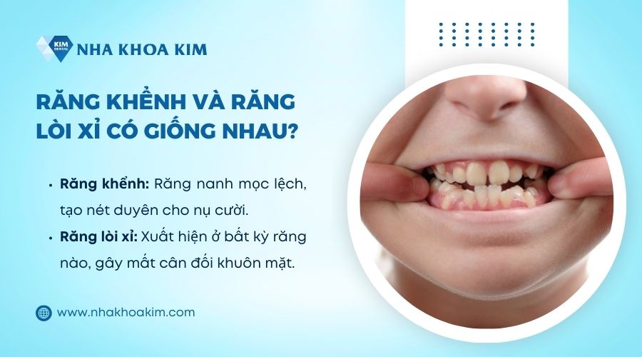 răng khểnh và răng lòi xỉ có giống nhau không
