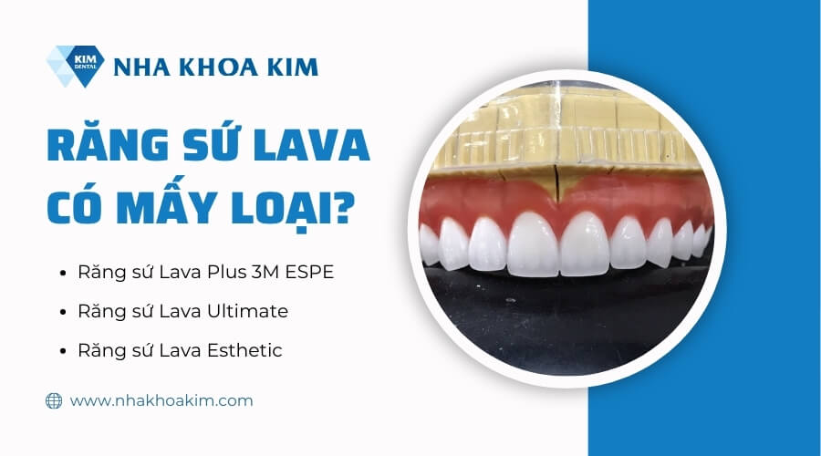 Răng sứ lava có mấy loại?