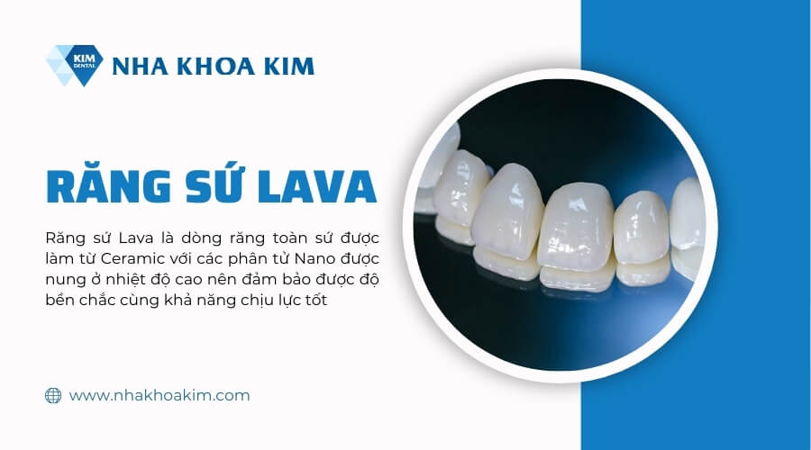 Răng sứ lava là gì?