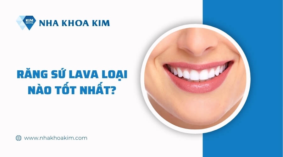 Răng sứ Lava loại nào tốt nhất?