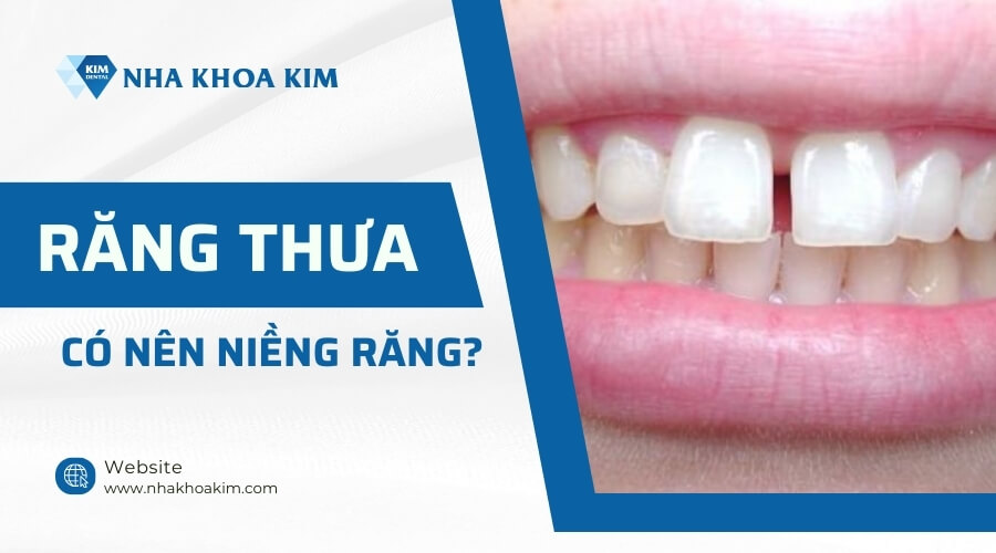 Răng thưa có nên niềng không?