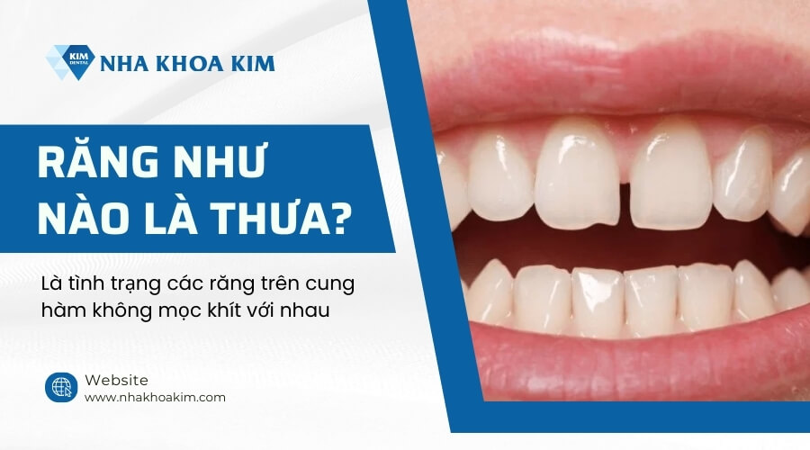 Răng như nào là thưa?