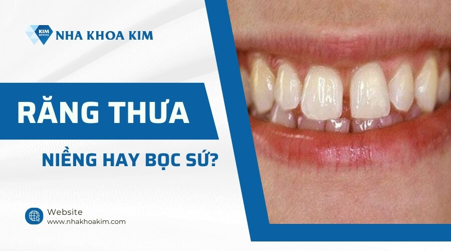 Răng thưa nên niềng hay bọc sứ tốt hơn?