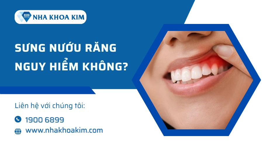 Sưng nướu răng có nguy hiểm không?
