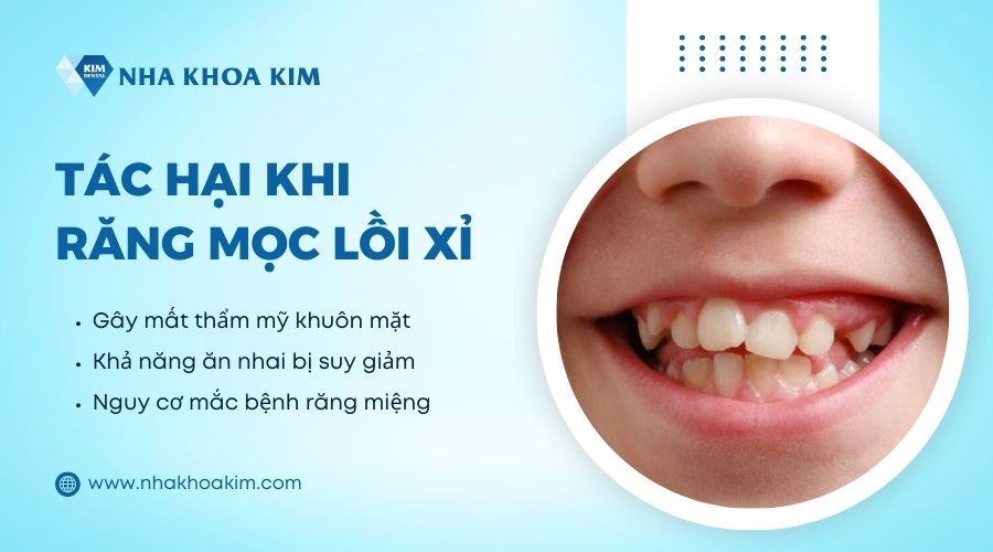 tác hại của răng mọc trồi