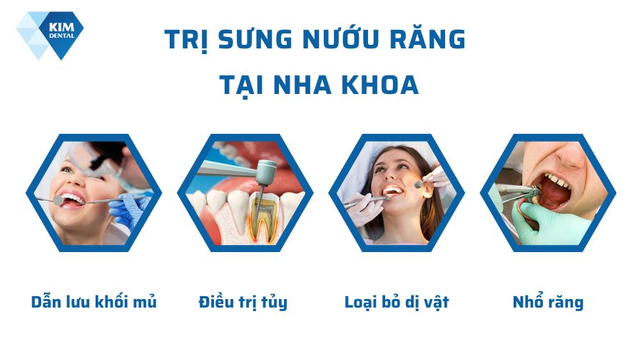 Cách trị sưng nướu răng tại nha khoa