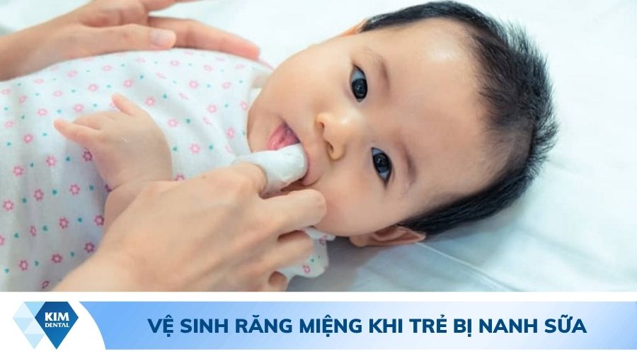 Cách vệ sinh răng miệng khi trẻ bị nanh sữa