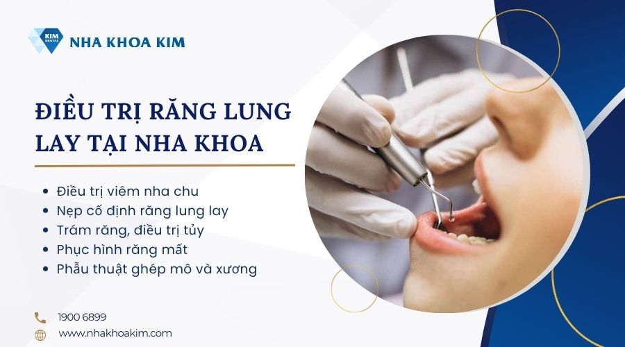 điều trị răng lung lay tại nha khoa