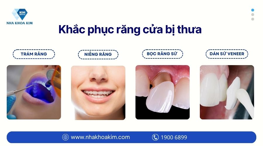 khắc phục răng cửa thưa