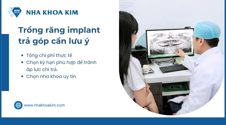 lưu ý khi trả góp dịch vụ trồng răng implant