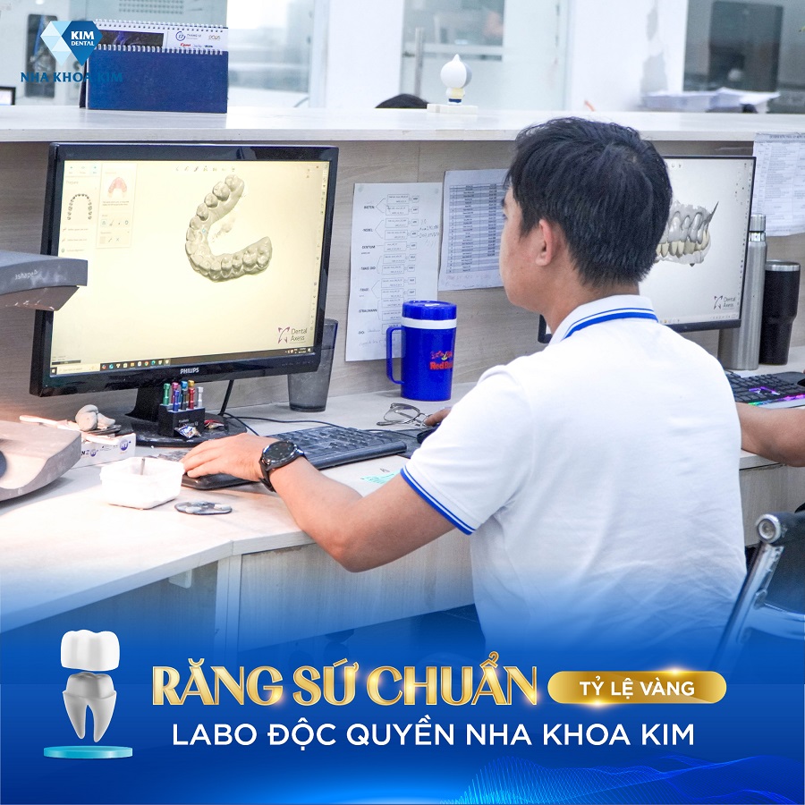 Nha Khoa Kim sở hữu Labo răng sứ nội bộ hiện đại rộng lớn tại Bình Dương