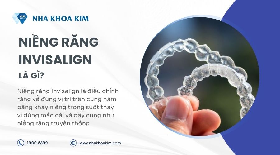 niềng răng invisalign là gì