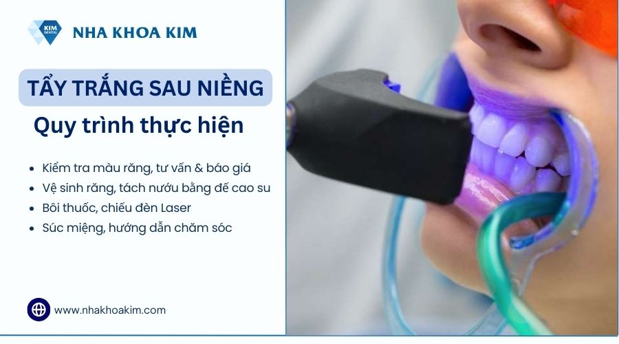 quy trình tẩy trắng răng sau niềng tại nha khoa kim