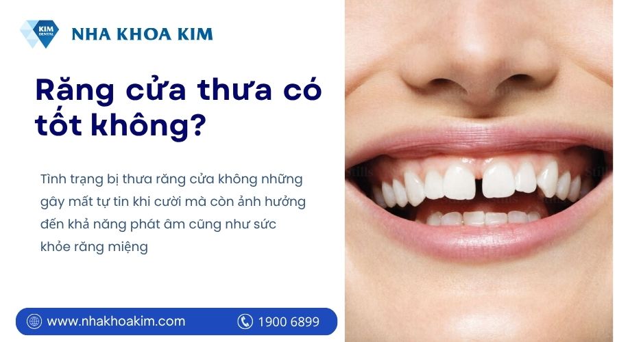 Bị thưa răng cửa tốt hay xấu