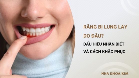 Răng bị lung lay do đâu? Dấu hiệu nhận biết và cách khắc phục