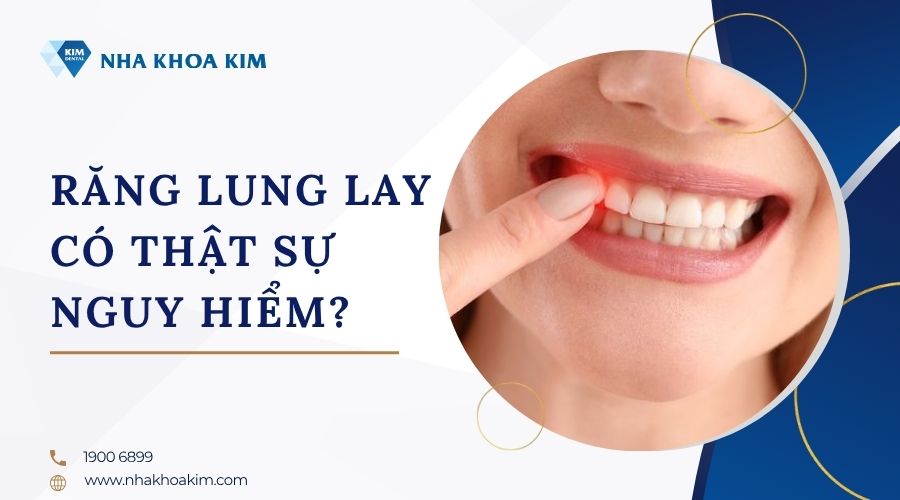 răng không còn chắc khỏe có sao không