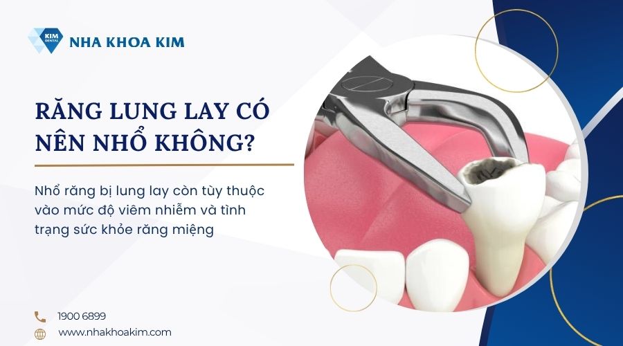 răng lung lay nhổ được không