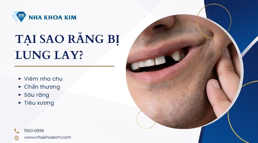 tại sao răng bị lung lay