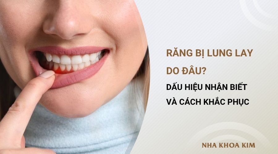 Răng bị lung lay do đâu? Dấu hiệu nhận biết và cách khắc phục
