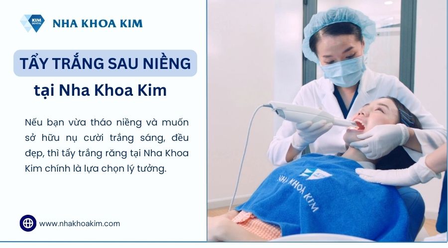 tẩy trắng răng sau niềng răng tại nha khoa kim