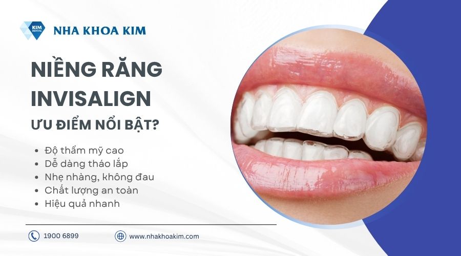 ưu điểm niềng răng invisalign