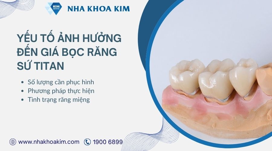 yếu tố ảnh hưởng đến giá răng sứ titan