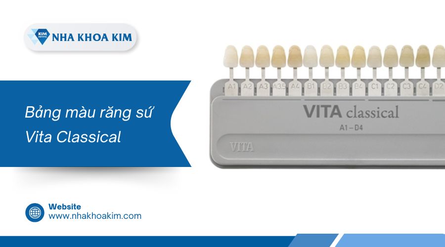 Bảng màu răng sứ Vita Classical
