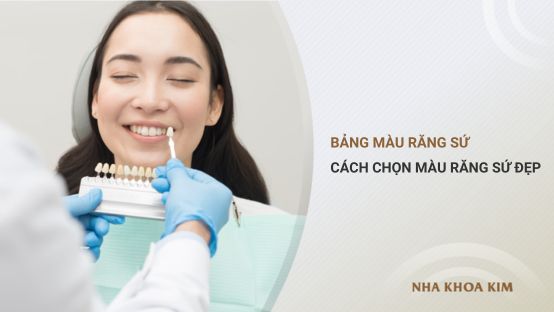 Bảng màu răng sứ: Cách chọn màu răng sứ đẹp, không bị lố