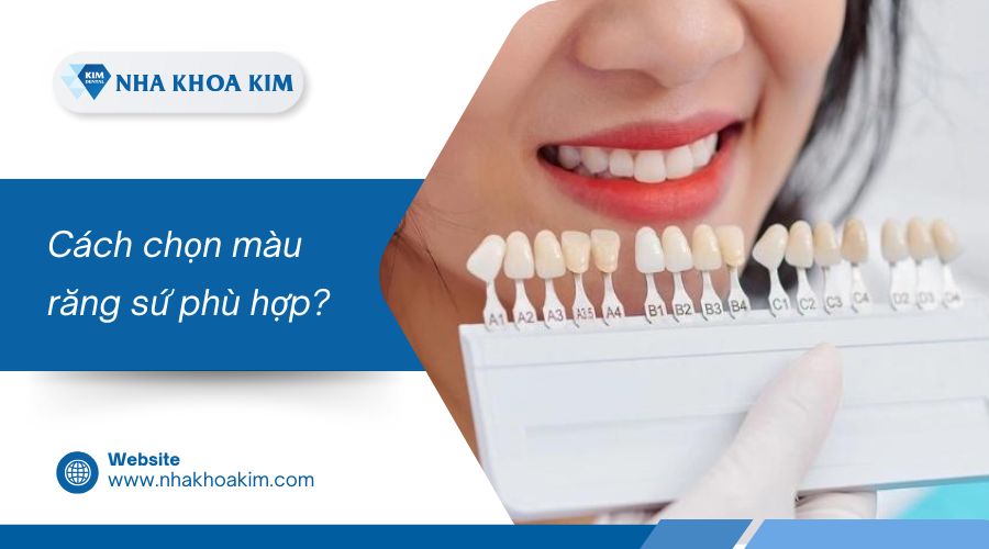 Cách chọn màu răng sứ phù hợp?