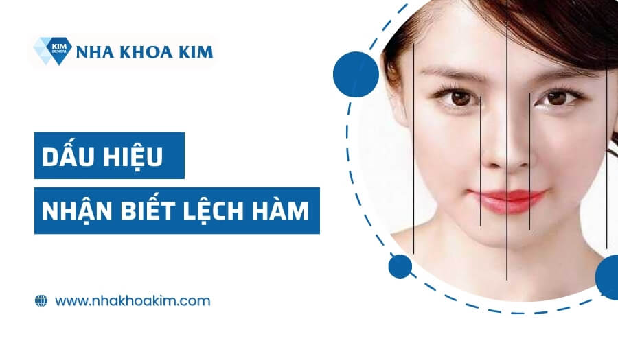 Dấu hiệu nhận biết lệch hàm