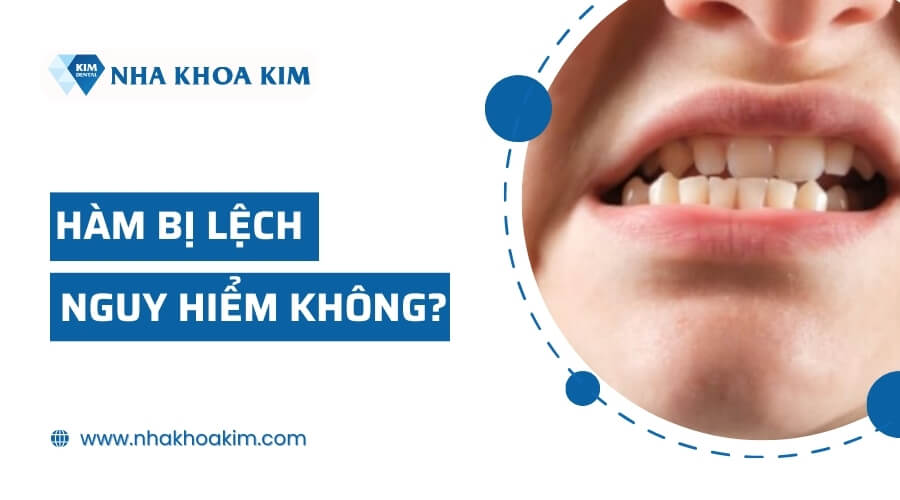 Lệch hàm có nguy hiểm không?