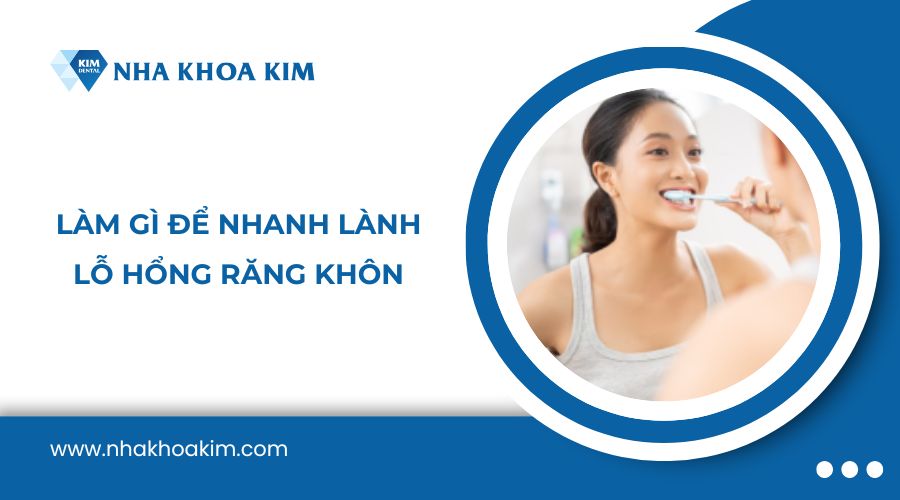 Làm gì để nhanh lành lỗ hổng răng khôn?