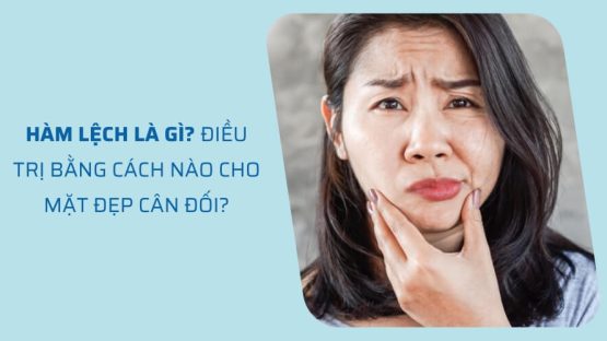 Hàm lệch là gì? Điều trị bằng cách nào cho gương mặt đẹp cân đối?