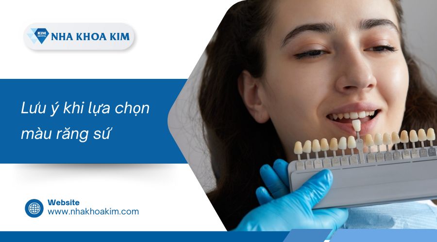 Lưu ý khi chọn màu răng sứ