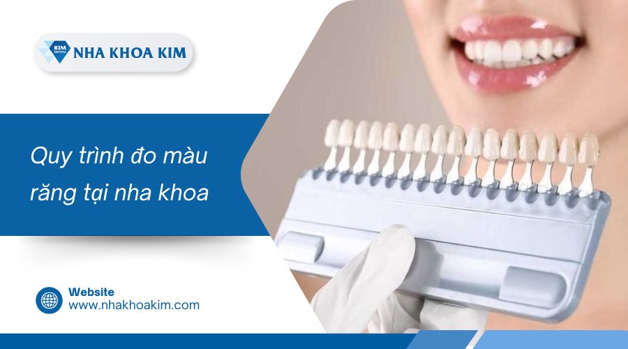 Quy trình đo màu răng tại nha khoa