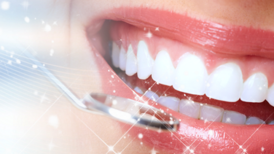 Răng sứ Cercon có mấy loại? Nha Khoa Kim làm răng sứ Cercon uy tín