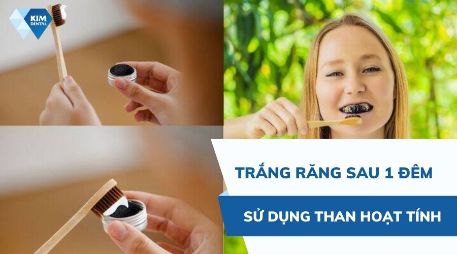 sử dụng than hoạt tính để làm trắng răng nhanh 