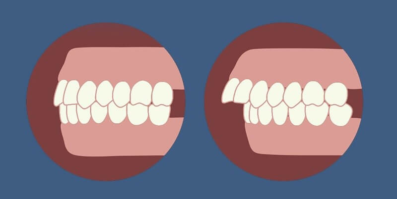 Bệnh nhân được khám tổng quát trước khi làm răng