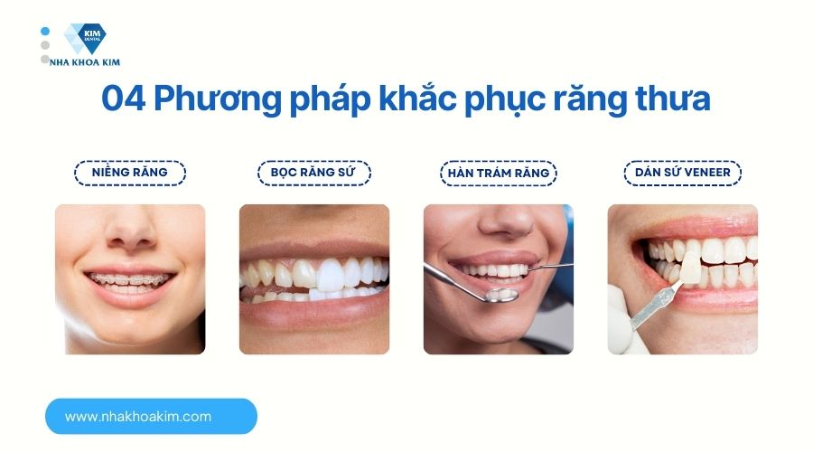 phương pháp khắc phục răng thưa hiệu quả 