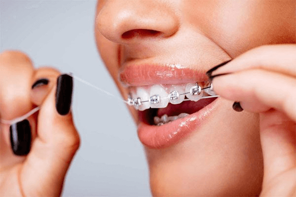 Kiểm tra tình trạng răng để lựa chọn phương thức niềng phù hợp