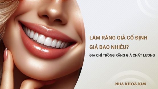Làm răng giả cố định giá bao nhiêu? Địa chỉ trồng răng giả chất lượng