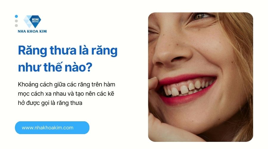 răng thưa là răng gì