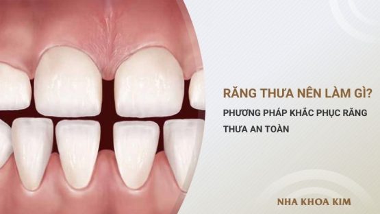 Răng thưa nên làm gì? Cách khắc phục răng thưa an toàn