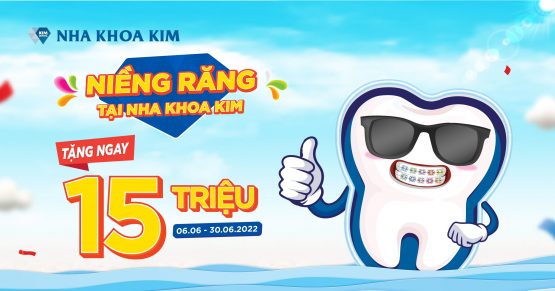 Hè niềng răng đẹp – Tặng ngay 15 triệu
