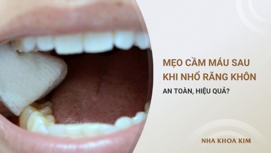 Cách cầm máu khi nhổ răng hiệu quả và nhanh chóng nhất