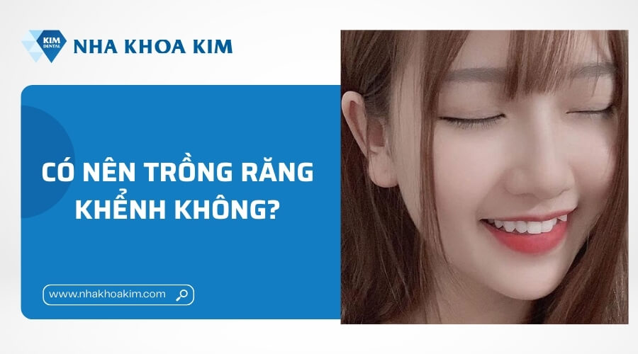 Có nên trồng răng khểnh không