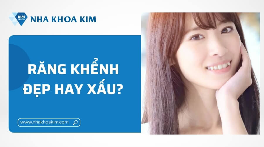 Răng khểnh đẹp hay xấu?