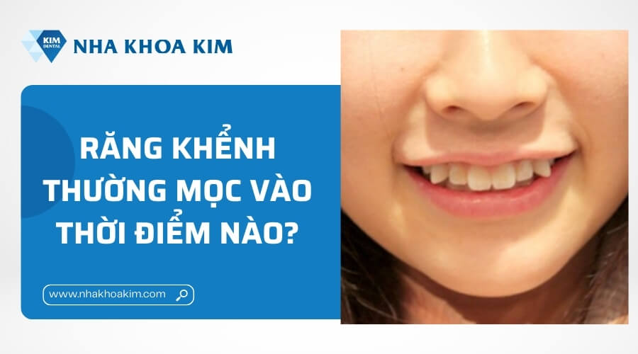 Răng khểnh mọc vào thời điểm nào